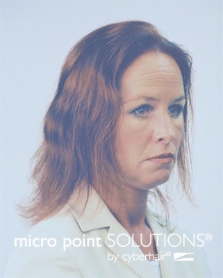 CyberHair Women's Hair Loss Solutions From Micro Point